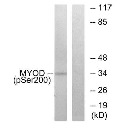 Western Blot - Anti-MYOD (phospho Ser200) Antibody (A0516) - Antibodies.com