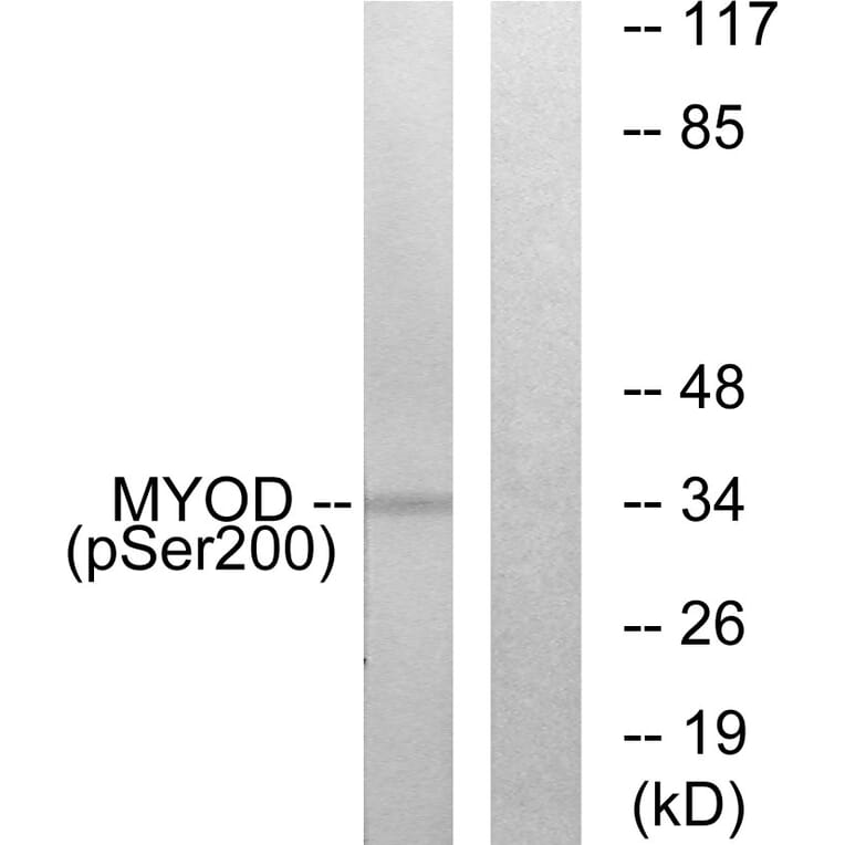 Western Blot - Anti-MYOD (phospho Ser200) Antibody (A0516) - Antibodies.com