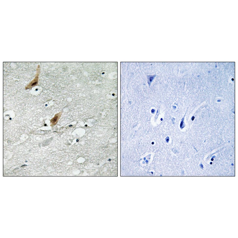 Immunohistochemistry - Anti-MSK2 (phospho Thr568) Antibody (A8149) - Antibodies.com
