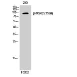 Western Blot - Anti-MSK2 (phospho Thr568) Antibody (A8149) - Antibodies.com
