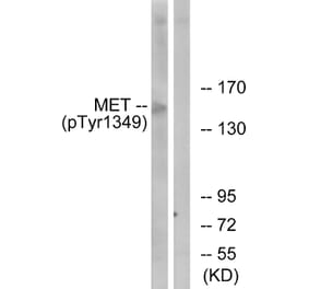 Western Blot - Anti-Met (phospho Tyr1349) Antibody (A7152) - Antibodies.com