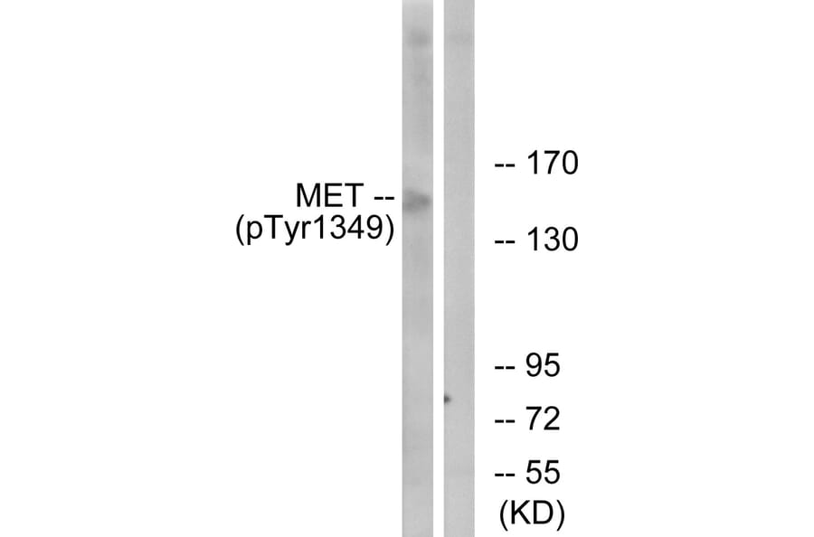Western Blot - Anti-Met (phospho Tyr1349) Antibody (A7152) - Antibodies.com