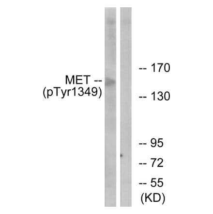 Western Blot - Anti-Met (phospho Tyr1349) Antibody (A7152) - Antibodies.com