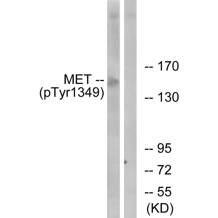 Western Blot - Anti-Met (phospho Tyr1349) Antibody (A7152) - Antibodies.com