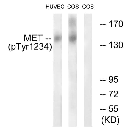Western Blot - Anti-Met (phospho Tyr1234) Antibody (A7151) - Antibodies.com