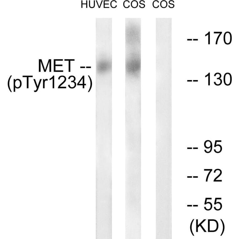 Western Blot - Anti-Met (phospho Tyr1234) Antibody (A7151) - Antibodies.com
