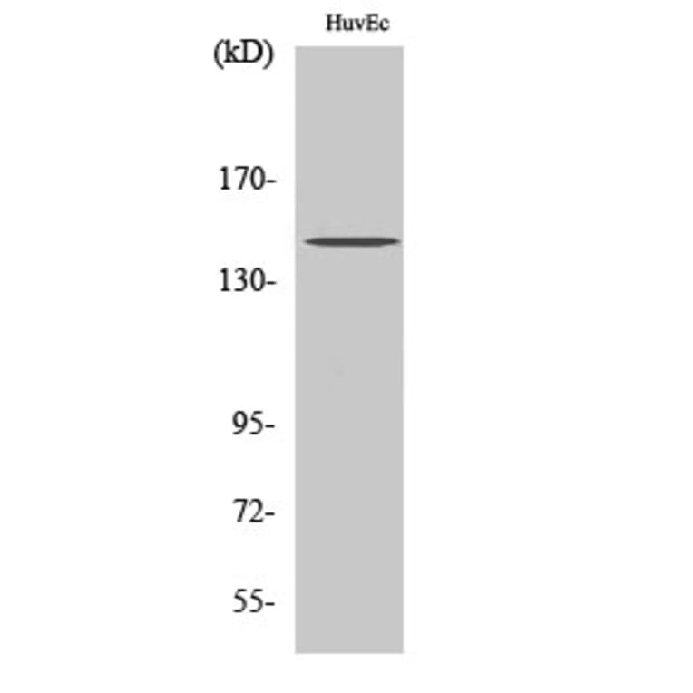 Western Blot - Anti-Met (phospho Tyr1234) Antibody (A7151) - Antibodies.com