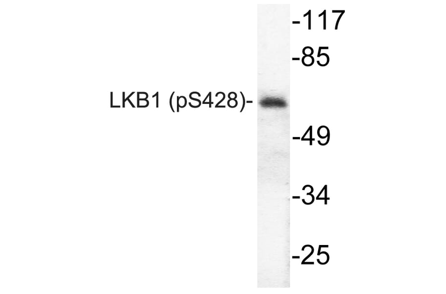 Western Blot - Anti-LKB1 (phospho Ser428) Antibody (P12-1032) - Antibodies.com