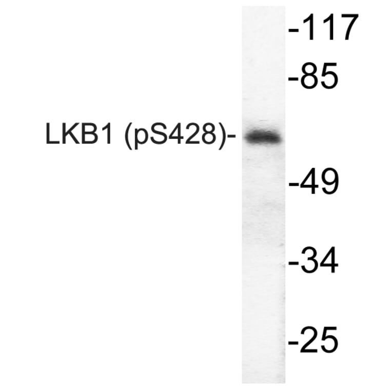 Western Blot - Anti-LKB1 (phospho Ser428) Antibody (P12-1032) - Antibodies.com
