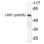 Western Blot - Anti-LKB1 (phospho Ser428) Antibody (P12-1032) - Antibodies.com