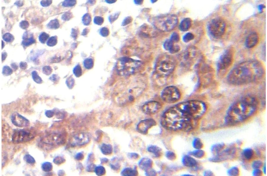 Immunohistochemistry - Anti-LKB1 (phospho Ser428) Antibody (P12-1032) - Antibodies.com