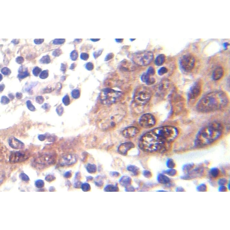 Immunohistochemistry - Anti-LKB1 (phospho Ser428) Antibody (P12-1032) - Antibodies.com
