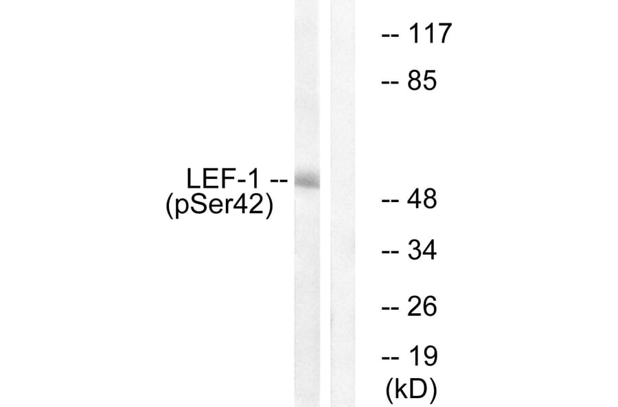 Western Blot - Anti-LEF-1 (phospho Ser42) Antibody (A1090) - Antibodies.com