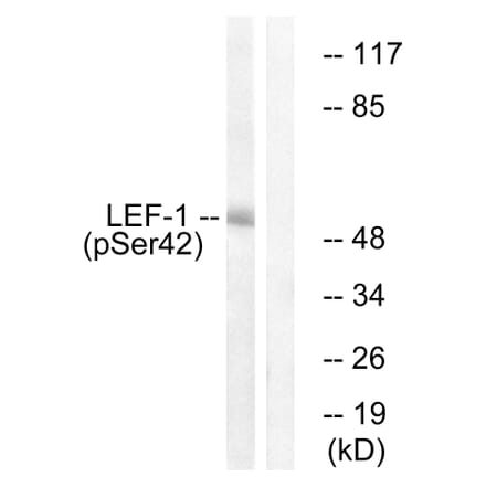 Western Blot - Anti-LEF-1 (phospho Ser42) Antibody (A1090) - Antibodies.com