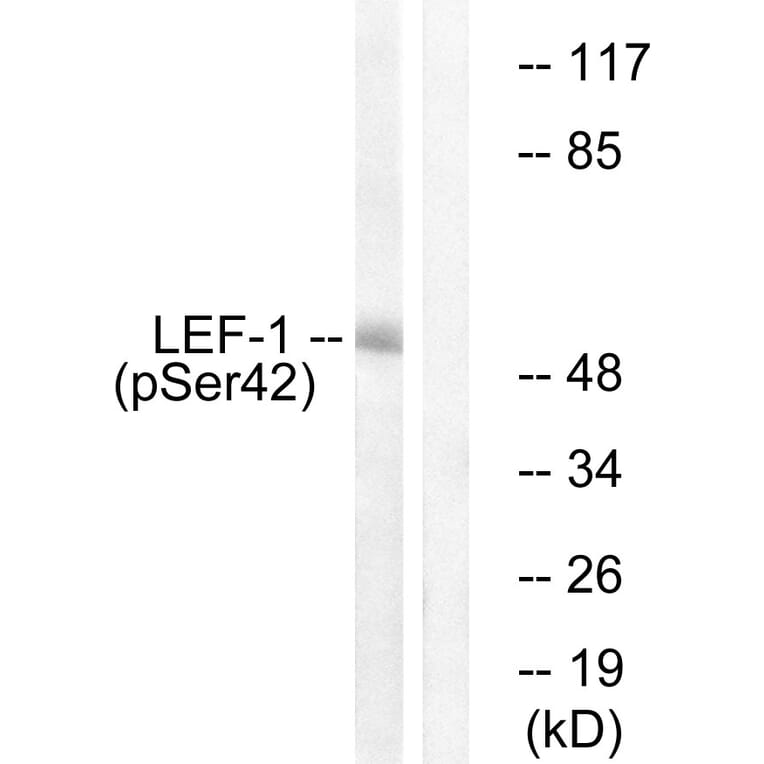 Western Blot - Anti-LEF-1 (phospho Ser42) Antibody (A1090) - Antibodies.com
