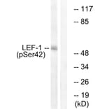 Western Blot - Anti-LEF-1 (phospho Ser42) Antibody (A1090) - Antibodies.com