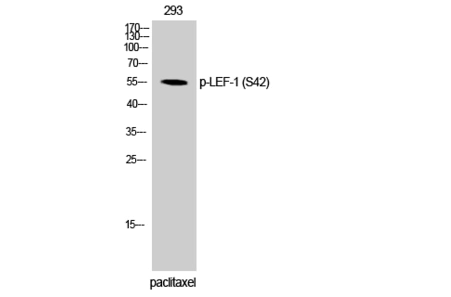 Western Blot - Anti-LEF-1 (phospho Ser42) Antibody (A1090) - Antibodies.com