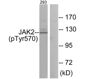 Western Blot - Anti-JAK2 (phospho Tyr570) Antibody (A0499) - Antibodies.com