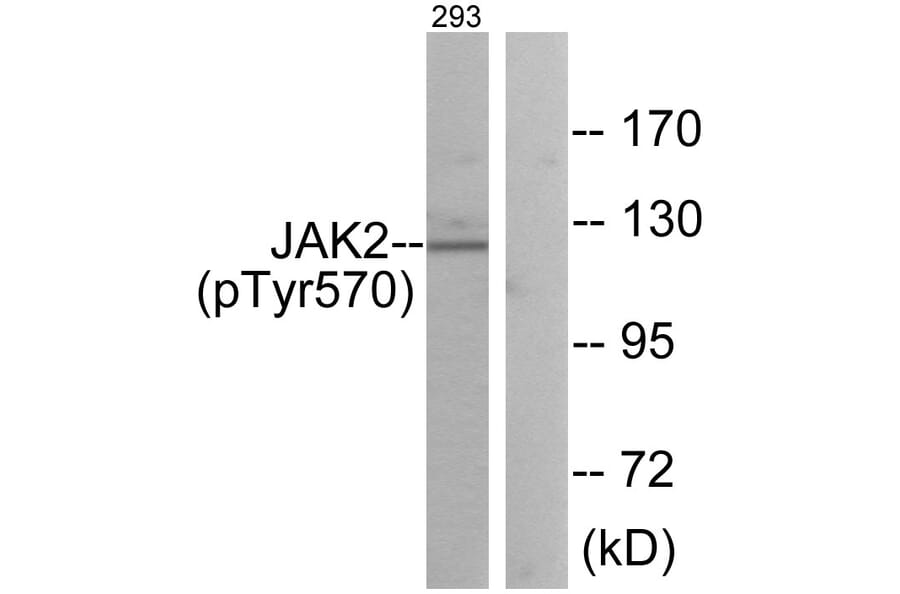 Western Blot - Anti-JAK2 (phospho Tyr570) Antibody (A0499) - Antibodies.com