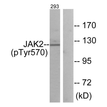 Western Blot - Anti-JAK2 (phospho Tyr570) Antibody (A0499) - Antibodies.com