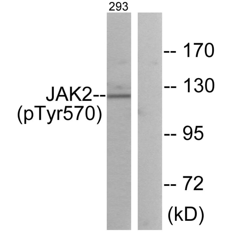 Western Blot - Anti-JAK2 (phospho Tyr570) Antibody (A0499) - Antibodies.com