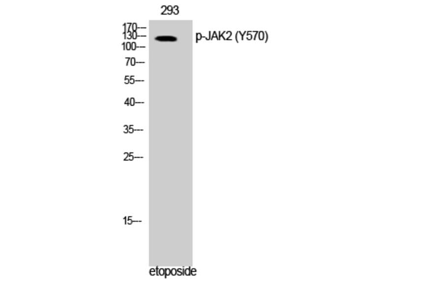Western Blot - Anti-JAK2 (phospho Tyr570) Antibody (A0499) - Antibodies.com