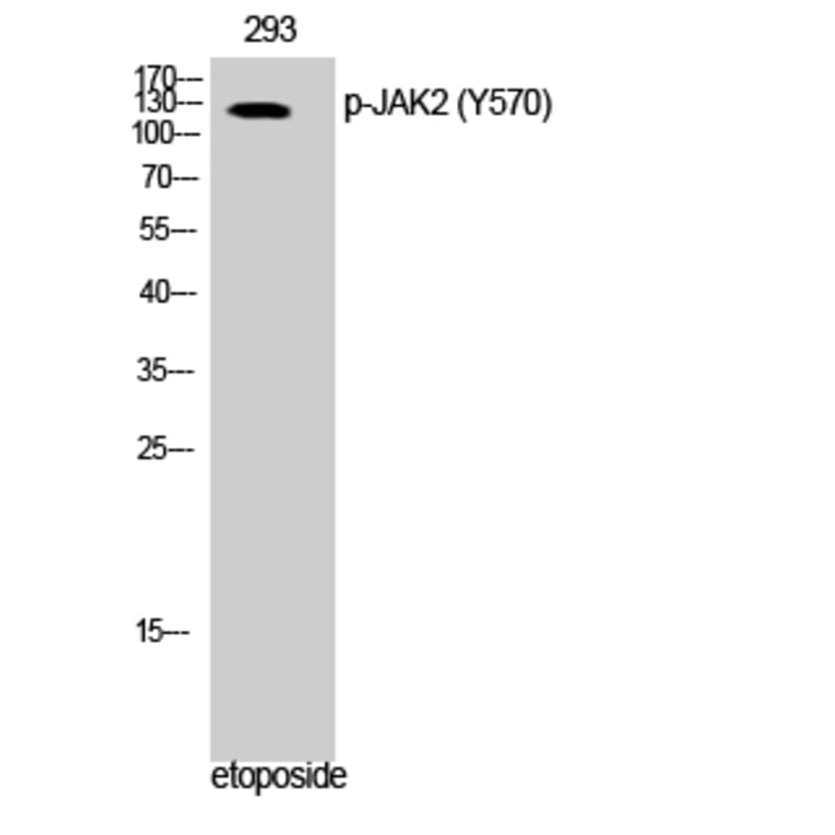 Western Blot - Anti-JAK2 (phospho Tyr570) Antibody (A0499) - Antibodies.com