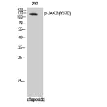 Western Blot - Anti-JAK2 (phospho Tyr570) Antibody (A0499) - Antibodies.com