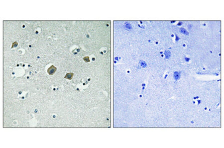 Immunohistochemistry - Anti-JAK2 (phospho Tyr570) Antibody (A0499) - Antibodies.com