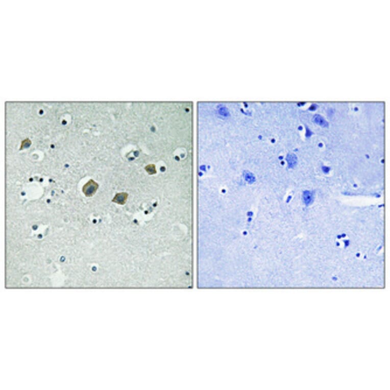 Immunohistochemistry - Anti-JAK2 (phospho Tyr570) Antibody (A0499) - Antibodies.com