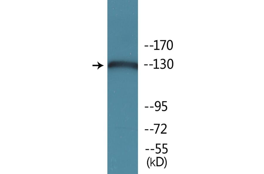 Western Blot - Anti-JAK2 (phospho Tyr570) Antibody (P12-1128) - Antibodies.com