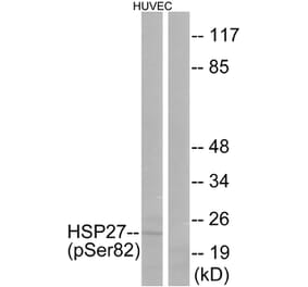 Western Blot - Anti-HSP27 (phospho Ser82) Antibody (A7112) - Antibodies.com