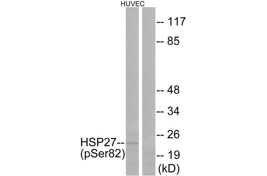 Western Blot - Anti-HSP27 (phospho Ser82) Antibody (A7112) - Antibodies.com