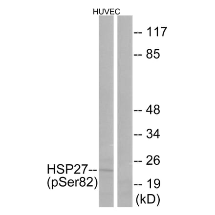 Western Blot - Anti-HSP27 (phospho Ser82) Antibody (A7112) - Antibodies.com
