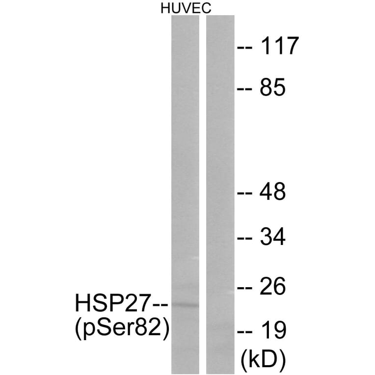 Western Blot - Anti-HSP27 (phospho Ser82) Antibody (A7112) - Antibodies.com