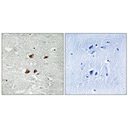 Immunohistochemistry - Anti-HSF1 (phospho Ser121) Antibody (A8041) - Antibodies.com