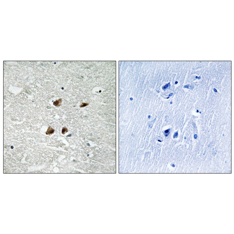 Immunohistochemistry - Anti-HSF1 (phospho Ser121) Antibody (A8041) - Antibodies.com