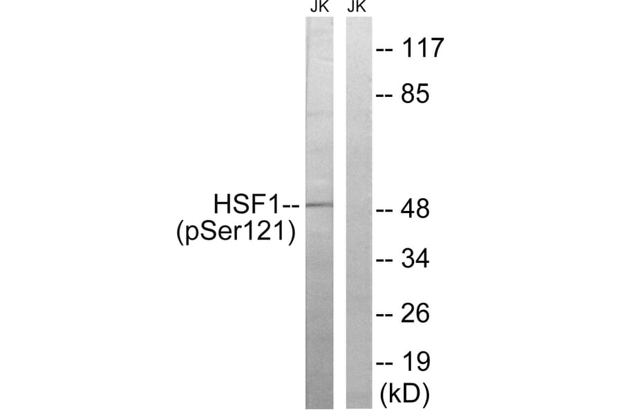 Western Blot - Anti-HSF1 (phospho Ser121) Antibody (A8041) - Antibodies.com