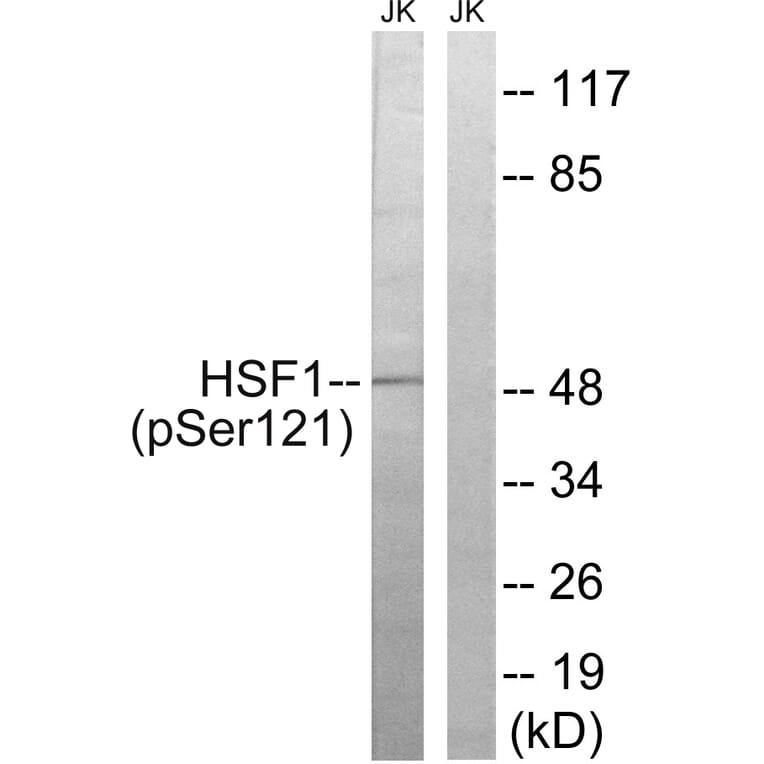 Western Blot - Anti-HSF1 (phospho Ser121) Antibody (A8041) - Antibodies.com