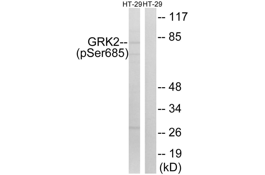 Western Blot - Anti-GRK2 (phospho Ser685) Antibody (A8278) - Antibodies.com