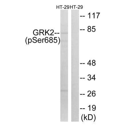 Western Blot - Anti-GRK2 (phospho Ser685) Antibody (A8278) - Antibodies.com