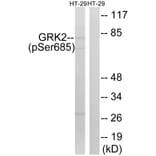 Western Blot - Anti-GRK2 (phospho Ser685) Antibody (A8278) - Antibodies.com