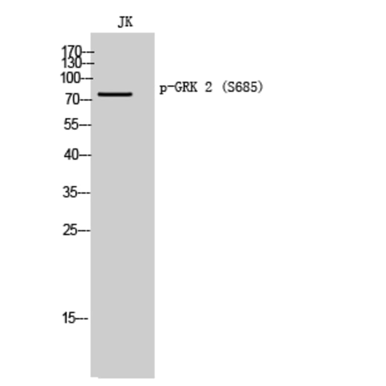 Western Blot - Anti-GRK2 (phospho Ser685) Antibody (A8278) - Antibodies.com