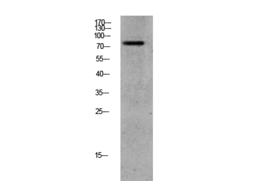 Western Blot - Anti-GRK2 (phospho Ser685) Antibody (A8278) - Antibodies.com