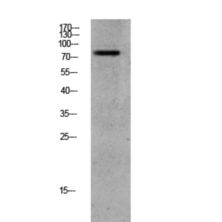 Western Blot - Anti-GRK2 (phospho Ser685) Antibody (A8278) - Antibodies.com