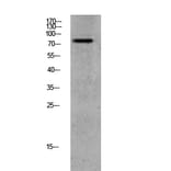 Western Blot - Anti-GRK2 (phospho Ser685) Antibody (A8278) - Antibodies.com