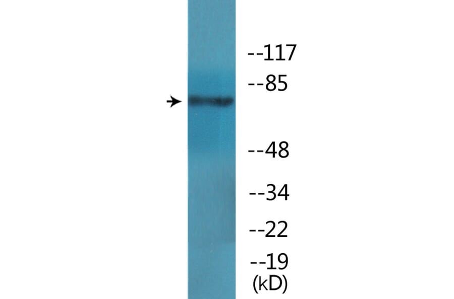 Western Blot - Anti-GRK2 (phospho Ser685) Antibody (P12-1112) - Antibodies.com