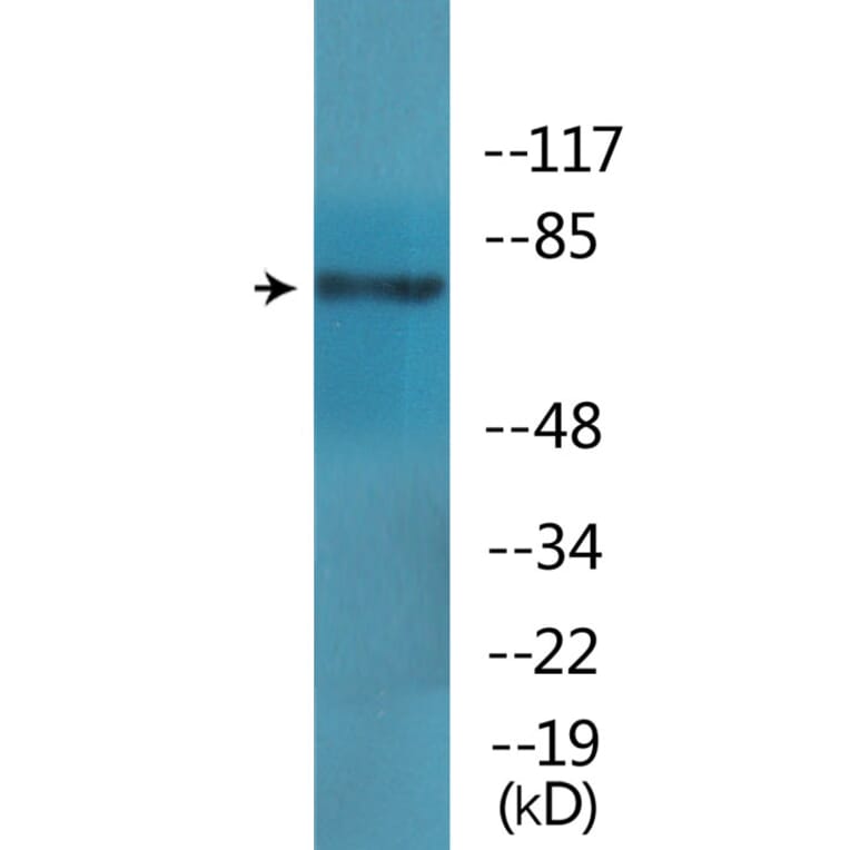 Western Blot - Anti-GRK2 (phospho Ser685) Antibody (P12-1112) - Antibodies.com