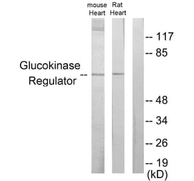 Western Blot - Anti-Glucokinase Regulator Antibody (C11030) - Antibodies.com