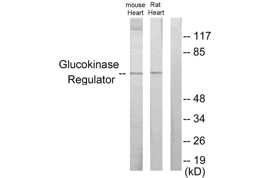 Western Blot - Anti-Glucokinase Regulator Antibody (C11030) - Antibodies.com